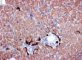 Cytokeratin-7 in ductular proliferation