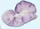 Fetal kidney 28 weeks