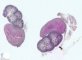 Fetal kidney 11 weeks