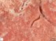 Pulmonary parenchyma