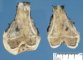 Warty keratosis in Rothmund-Thomson syndrome