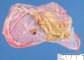 Pre-pancreatic mucinous cystadenoma
