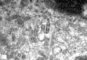 Birbeck granules