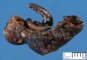 Ileocecal region necrosis in a neonate