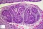 Early nephrogenesis in embryo