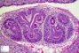 EMbryonic kidney