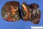 Dilatation of large bile ducts in extrahepatic biliary tract (...)