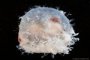 Embryo 16 mm / 6-7 weeks
