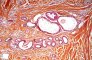Cutaneous apocrine glands