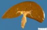 Hepatic hilus with gallbladder