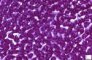 PAS coloration of hepatocytic cytoplasm (before diastase)