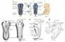 Neural tube closure in humans