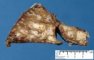 Bronchiectasis and BALT hyperplasia (Case 11750)