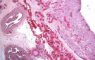 Fetal ovary (22 weeks)