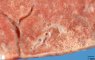 Pulmonary alveoles