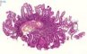 Intestinal mucosa biopsy